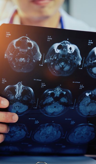 Neurologie timisoara Medijur